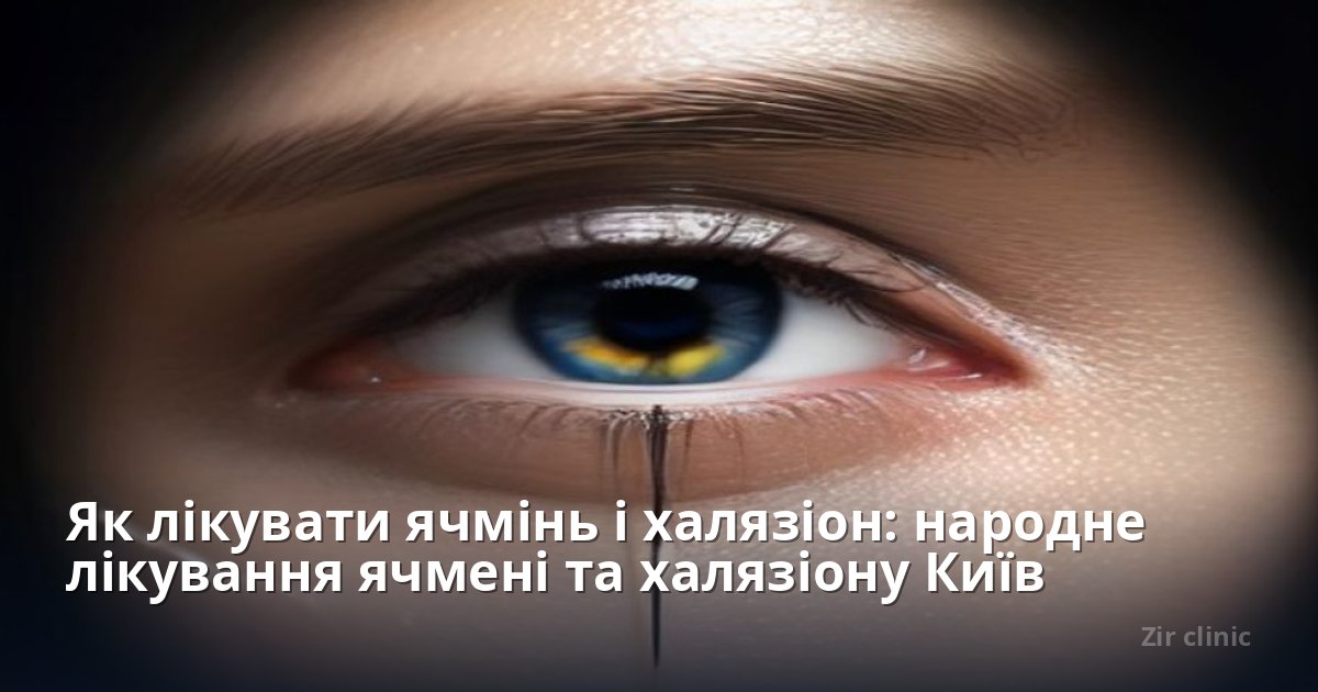 Як лікувати ячмінь і халязіон: народне лікування ячмені та халязіону Київ